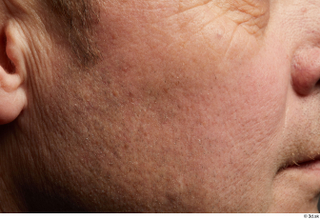 HD Skin Jake Perry cheek face skin pores skin texture…